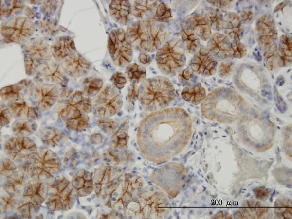 Monoclonal Mouse anti-Human RHCG Antibody (clone 5A4, IHC, WB)