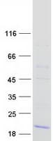 Human TRAPPC2 / SEDL Protein (Recombinant Myc-DDK (Flag))