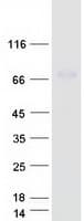 Human ENTPD4 / LALP70 Protein (Recombinant Myc-DDK (Flag))