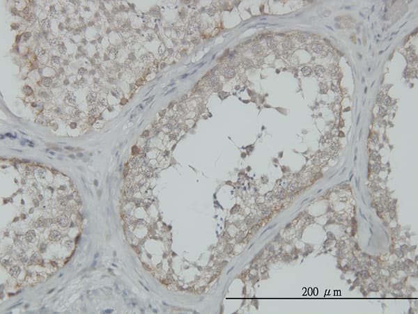 MAP3K4 / MEKK4 Antibody (clone 6C6)