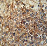 CD46 Antibody (aa317-343)