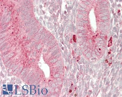 IHC-plus™ Polyclonal Rabbit anti-Human GUSB / Beta Glucuronidase Antibody (aa310-359, IHC, WB)