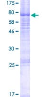 Human LIPH / Lipase Member H Protein (Recombinant GST)