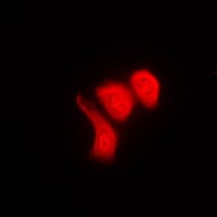 HNRNPK / hnRNP K Antibody (phospho-Ser284)