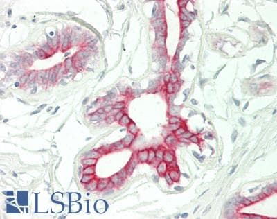 IHC-plus™ KRT19 / CK19 / Cytokeratin 19 Antibody (aa240-390, clone 8H7)