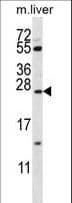 IHC-plus™ SFTPC / Surfactant Protein C Antibody (aa1-30)
