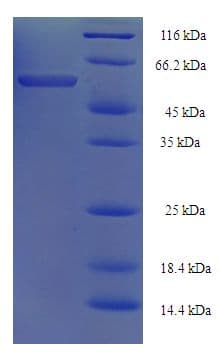 Cryptomeria japonica Polygalacturonase Protein (Recombinant His-SUMO)