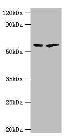 Polyclonal Rabbit anti-Human ALAS2 Antibody (aa50-320, IHC, WB)