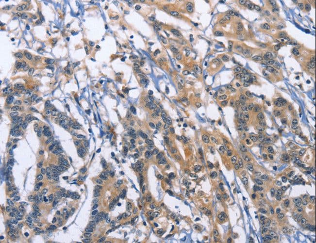 SYT17 Antibody