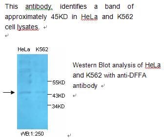 DFFA / ICAD / DFF45 Antibody