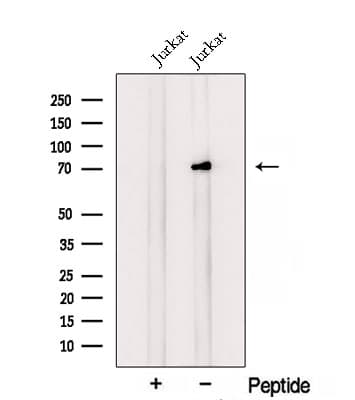 RLIM / RNF12 Antibody