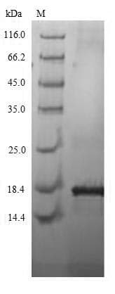 Human CT83 / CXorf61 Protein (Recombinant 6His, N-terminus)
