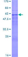 Human TUSC3 Protein (Recombinant GST)