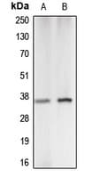 Polyclonal Rabbit anti-Human CA5A / Carbonic Anhydrase VA Antibody (Internal, WB)