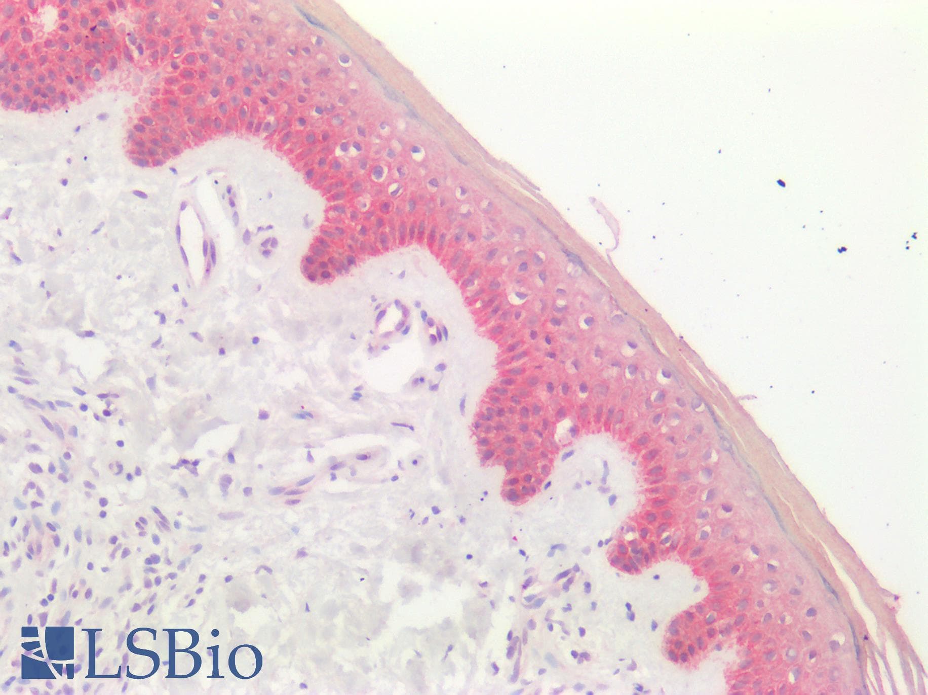 IHC-plus™ KRT7 / CK7 / Cytokeratin 7 Antibody