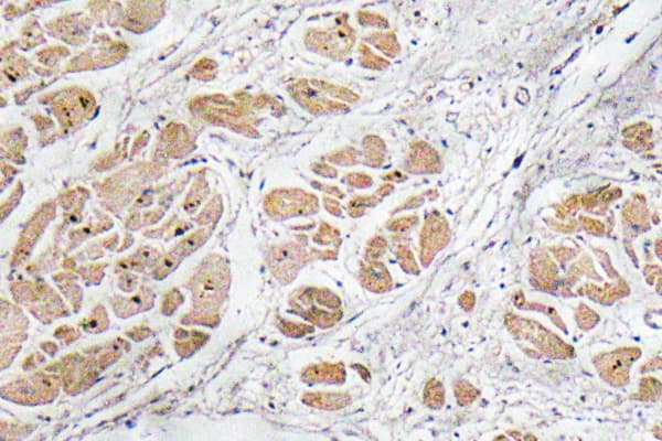 Polyclonal Rabbit anti-Human GNRH Antibody (aa43-92, IHC)