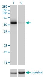 Monoclonal Mouse anti-Human CDC25C Antibody (clone 3B11, IHC, WB)