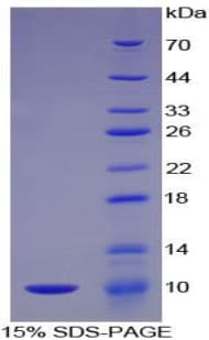 Mouse Complement C5a Protein (Recombinant His-T7)