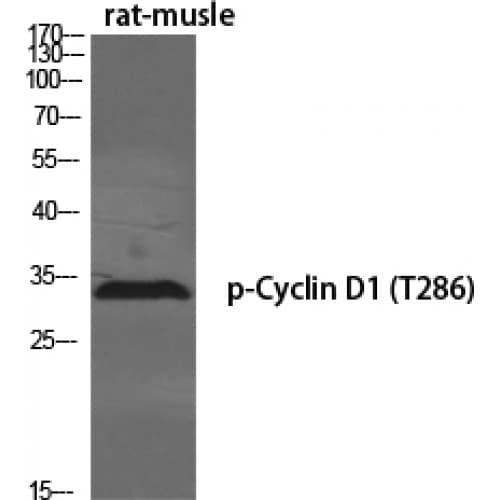 CCND1 / Cyclin D1 Antibody (220-300 aa)