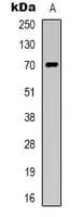 IHC-plus™ SLC6A6 / Taurine Transporter Antibody (C-Terminus)