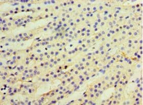 CCBL2 Antibody (aa1-454, Biotin)