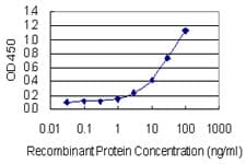 GAD65 Antibody (clone 3G3)