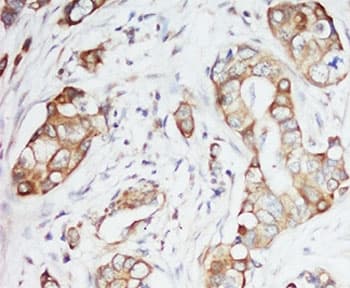 IGF1 Antibody (aa80-96)