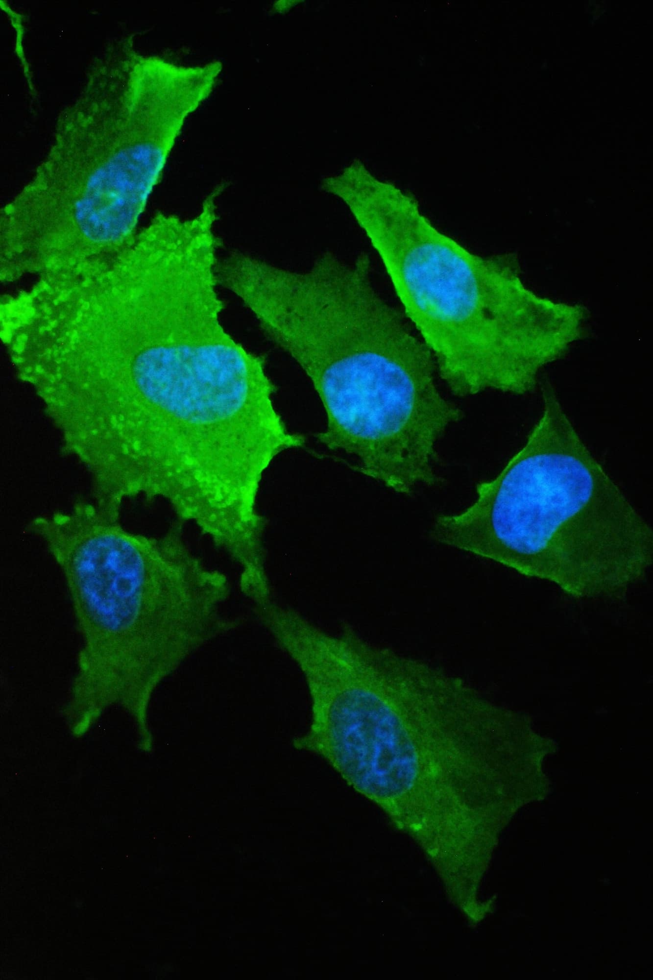 S100A10 Antibody