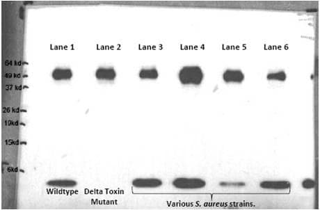Polyclonal Rabbit anti-Staphylococcus aureus S. aureus Delta Hemolysin Antibody (WB)