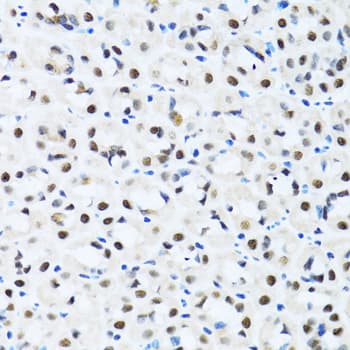 CCAR2 / KIAA1967 Antibody