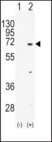TXK / RLK Antibody (aa22-52)
