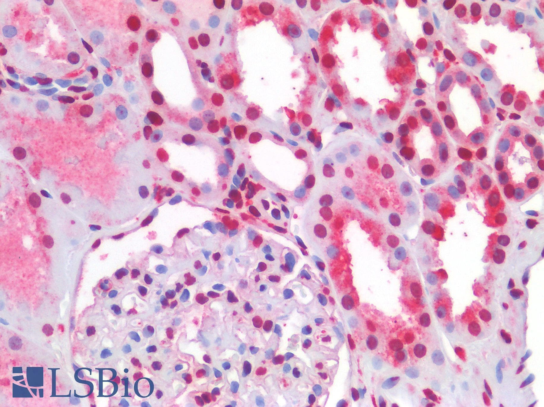 PathPlus™ NALP3 / NLRP3 Antibody