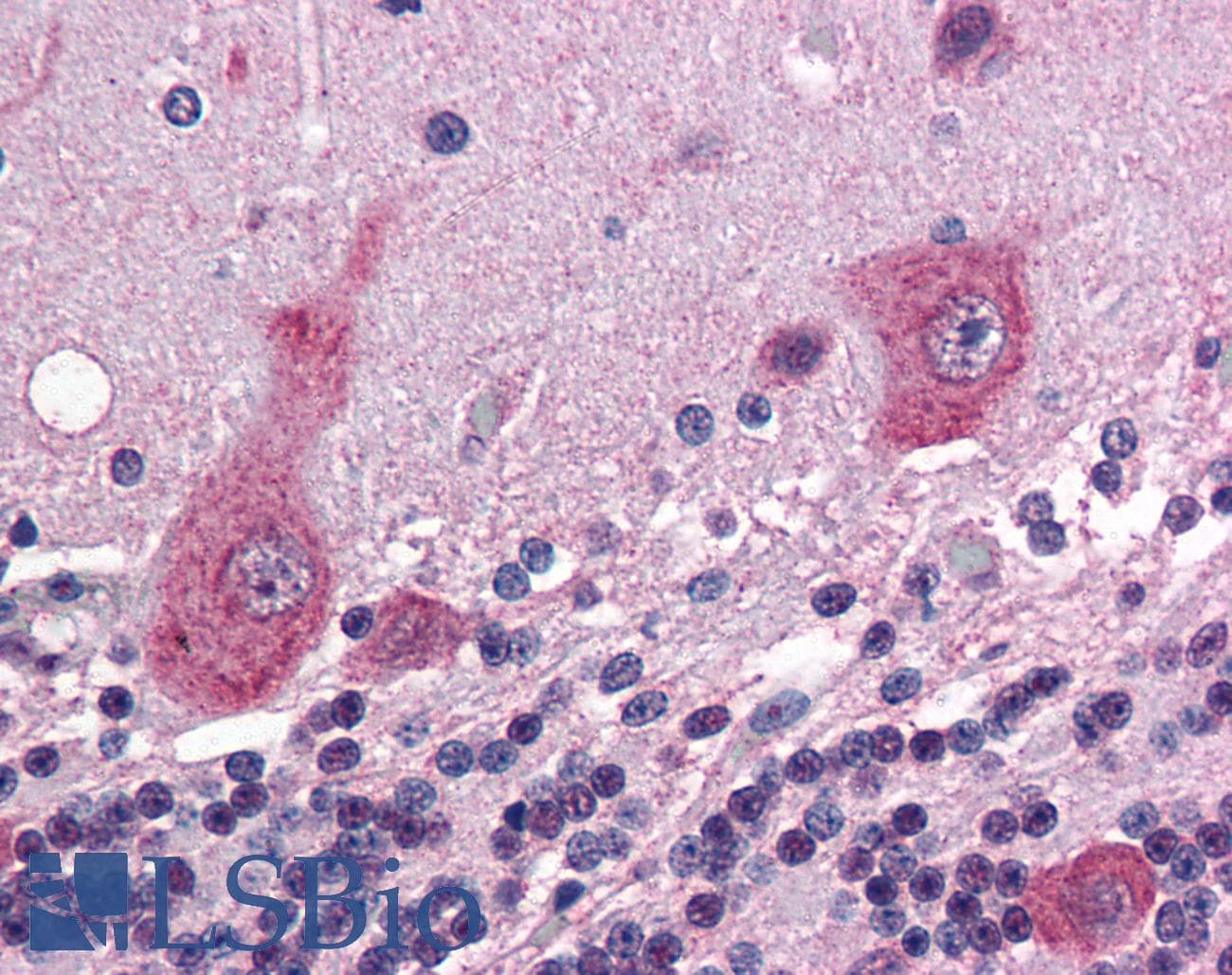 IHC-plus™ GRIK5 / KA2 Antibody