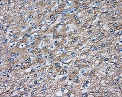 DNTTIP1 / TDIF1 Antibody (clone OTI1E2)