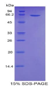 Human SULF2 / Sulfatase 2 Protein (Recombinant His-GST)