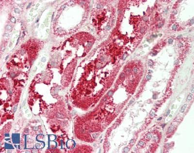 PathPlus™ CX3CL1 / Fractalkine Antibody (aa25-332)