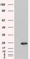 AK1 / Adenylate Kinase 1 Antibody (clone OTI8A1)