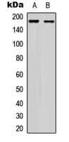 IHC-plus™ EGFR Antibody (Internal)