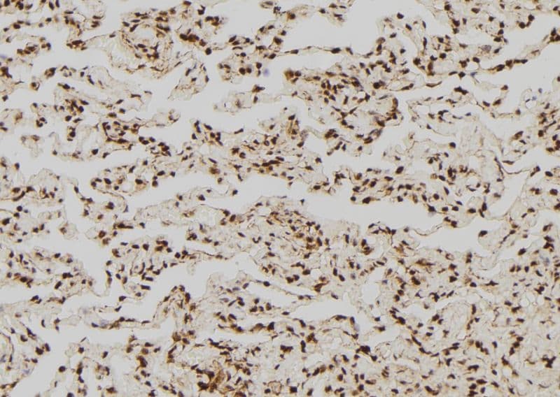ARHGAP35 / GRLF1 Antibody (phospho-Tyr1105)