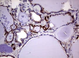 GSTP1 / GST Pi Antibody (clone OTI4B6, Carrier-free)
