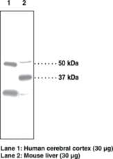 IHC-plus™ PPARD / PPAR Delta Antibody (aa39-54)