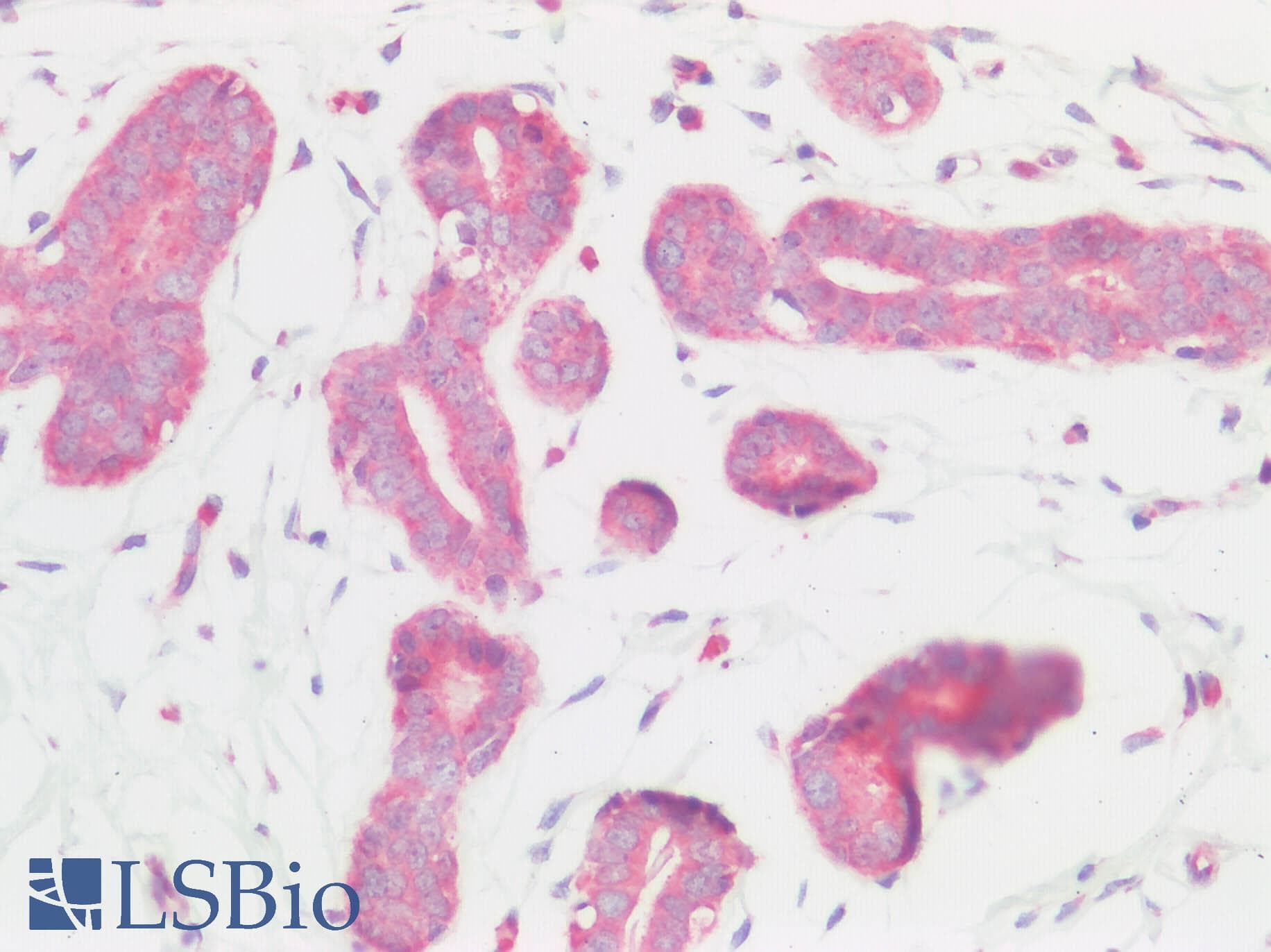 PathPlus™ Polyclonal Rabbit anti-Human BMP6 Antibody (IHC)