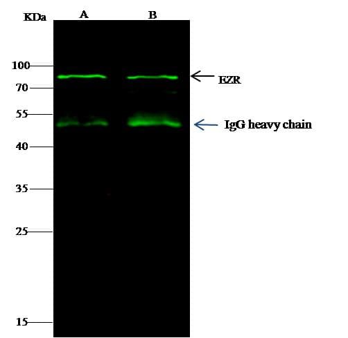 Monoclonal Mouse anti-Human EZR / Ezrin Antibody (clone 02, Preservative Free, WB)