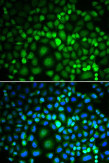 TIP48 / RUVBL2 Antibody