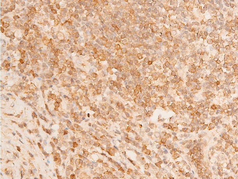 TP73 / p73 Antibody (phospho-Tyr99)