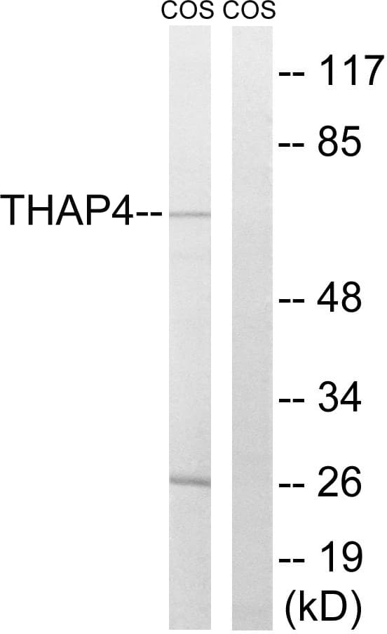 Polyclonal Rabbit anti-Human THAP4 Antibody (aa341-390, WB)
