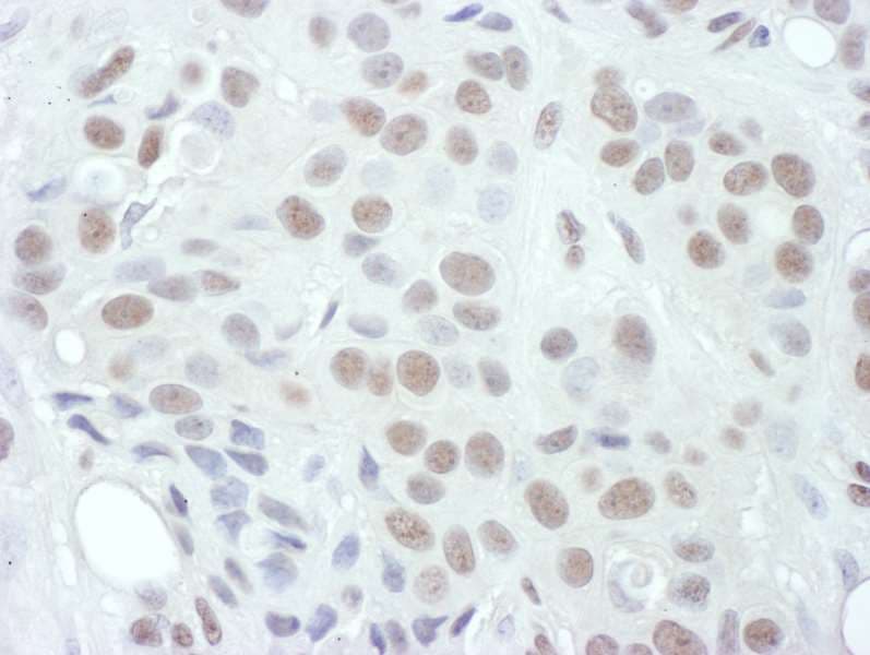 Polyclonal Rabbit anti-Human MAP2K1 / MKK1 / MEK1 Antibody (phospho-Thr286, IHC)