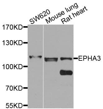 EPHA3 / EPH Receptor A3 Antibody