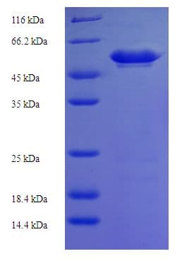 Human MAP2K3 / MEK3 / MKK3 Protein (Recombinant His-SUMO)