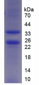 Mouse MPS1 / TTK Protein (Recombinant His-T7)
